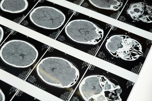 The Cognitive Cost: What Using AI Is Actually Doing To Our Brains